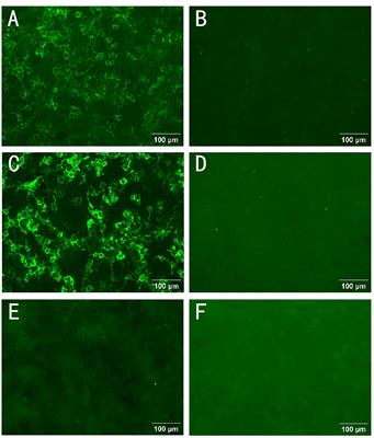 Autoimmune nodopathy with anti-contactin 1 antibody characterized by cerebellar dysarthria: a case report and literature review